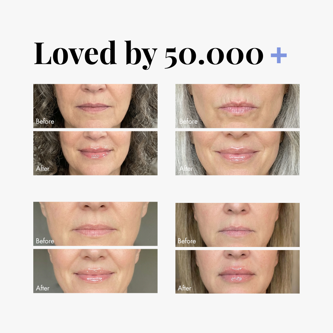 Extreme Lip Plumper